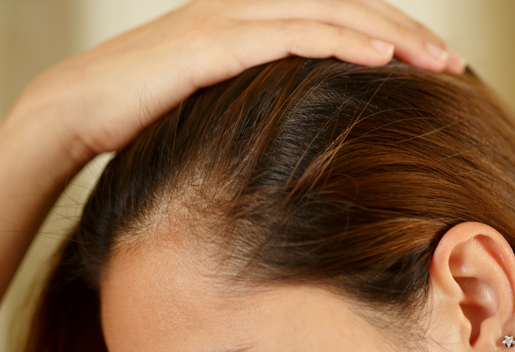 Why is my hair thinning? Can a Hair Loss Shampoo Help?