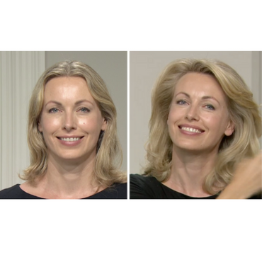 volumising hair treatments for women hair loss