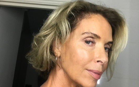 hair loss treatment boots uk 