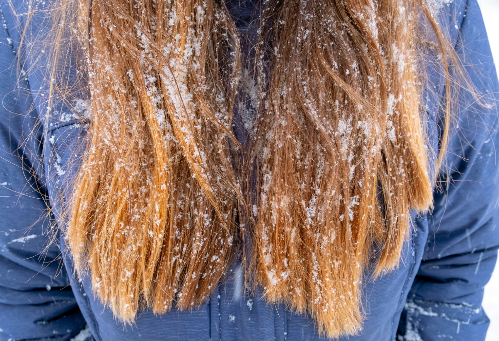 Is your hair feeling winter weary? Could it use a health boost?