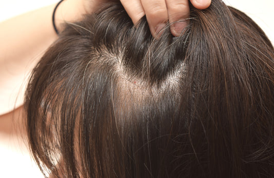 menopause hair loss shampoo boots UK 
