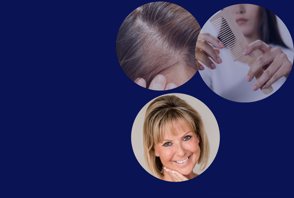 Natucain best seller hair growth serum menopause 